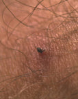 Lifesystems Tick Remover Card
little tick